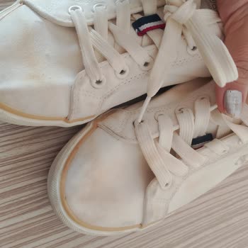 Kadın Sneaker’da Kısa Sürede Sarı Lekeler