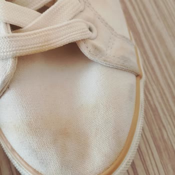 Kadın Sneaker’da Kısa Sürede Sarı Lekeler