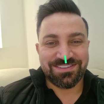 Yanıltıcı Diş Estetiği Eksik Kanal Tedavisi Ve Ücret İadesi Talebi