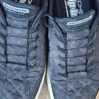 Skechers Günlük Ayakkabıda Hızlı Bozulma Ve Çözümsüz Değişim Reddi