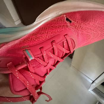 Skechers Ayakkabısında Yırtılma, Üretim Kaynağı Reddi Ve Müşteri Hizmetinden Yetersiz Çözüm