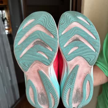 Skechers Ayakkabısında Yırtılma, Üretim Kaynağı Reddi Ve Müşteri Hizmetinden Yetersiz Çözüm