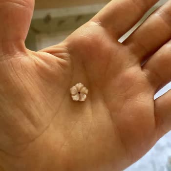 Pembe Sedef İnci Yüzüğün Kırılması Ve İade Sürecindeki Gecikme