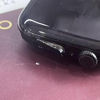 Apple Watch 10 Düğme Arızası Ve Boya Atması İçin 22.920 TL Değişim Ücreti Haksız