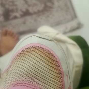 Nike Koşu Ayakkabısının Kısa Sürede Deforme Olması Ve Mağaza İlgisizliği