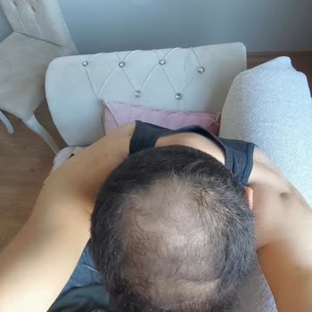 Fiyat Değişikliği Ve Saç Ekimi Sonuçlarının Hayal Kırıklığı