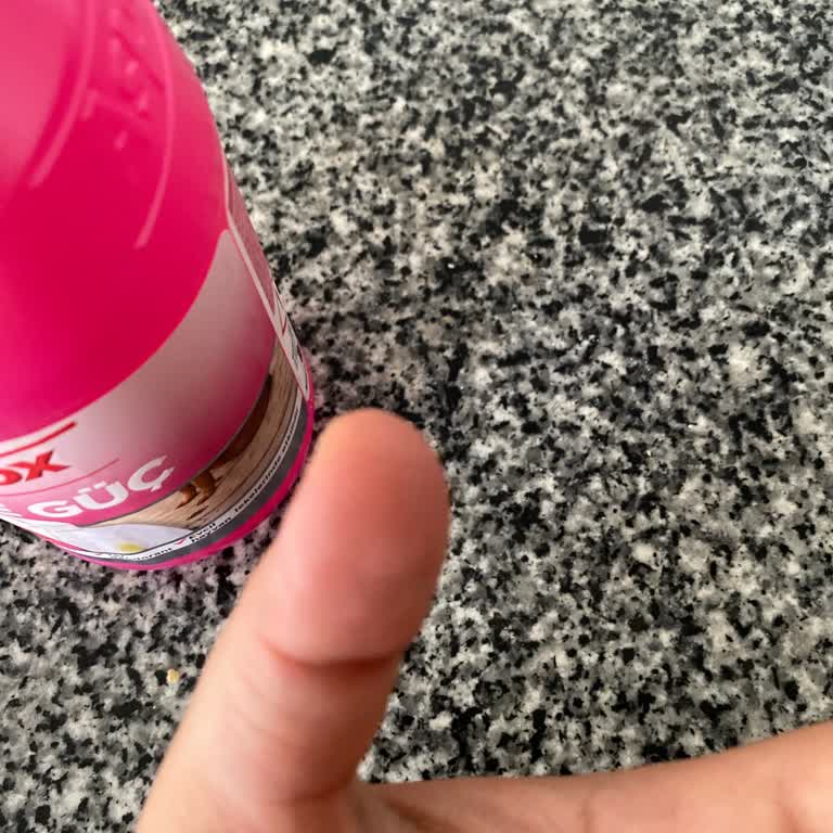 Asperox Pembe Güç Leke Çıkarıcı İle Şiddetli Cilt Yanması Ve Şişlik