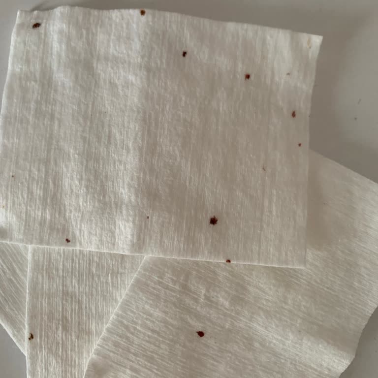 Alt Temizleme Pamuğunda Kırmızı Sert Kalıntılar Ve İade Talebi