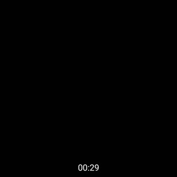 Video Görüşme Çalışmıyor, Botslab Yetkilileri Yardımcı Olmuyor