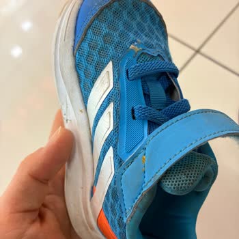 Adidas Duramo Çocuk Ayakkabısının Kalıp Sorunu Çocuğumun Ayağını Sıkıyor Ve Kızarıklığa Neden Oluyor