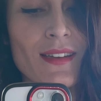 Özel Ayvalık Ağız Ve Diş Polikliniği Porselen Lamine Diş Kırıldı