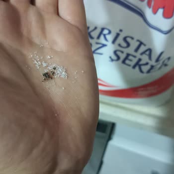 Yabancı Madde İçeren Toz Şeker Paketi