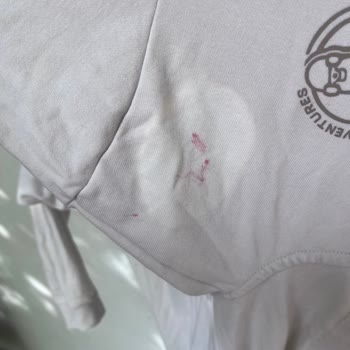 Stop Leke Çıkarıcı Çocuk Kıyafetini Renksiz Bırakıp Kullanılamaz Hale Getirdi