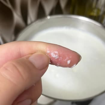 Doruk Markalı Çiğ Sütte Kıl Çıktı Ve Sağlık Endişesi