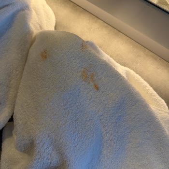Crystal Centro Hotel’de Temizlik, Yemek Ve Sağlık Hizmetlerinde Çöküş
