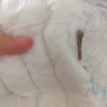 Molfix 5 Numaralı Bebek Bezinde Yabancı Madde Ve Kahverengi Leke, Hijyen Endişesi Ve Telafi Talebi