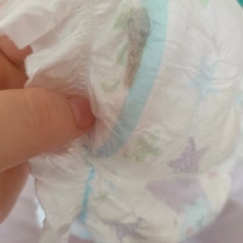 Molfix 5 Numaralı Bebek Bezinde Yabancı Madde Ve Kahverengi Leke, Hijyen Endişesi Ve Telafi Talebi