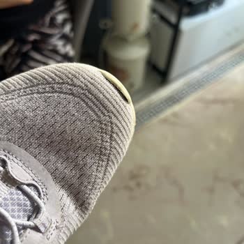 İki Yıllık Garanti Verilen Skechers Yürüyüş Ayakkabısında Yan Açılma Ve Kullanıcı Hatası İddiası