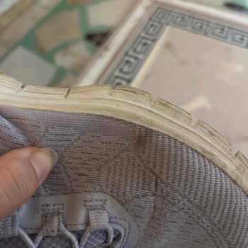 İki Yıllık Garanti Verilen Skechers Yürüyüş Ayakkabısında Yan Açılma Ve Kullanıcı Hatası İddiası