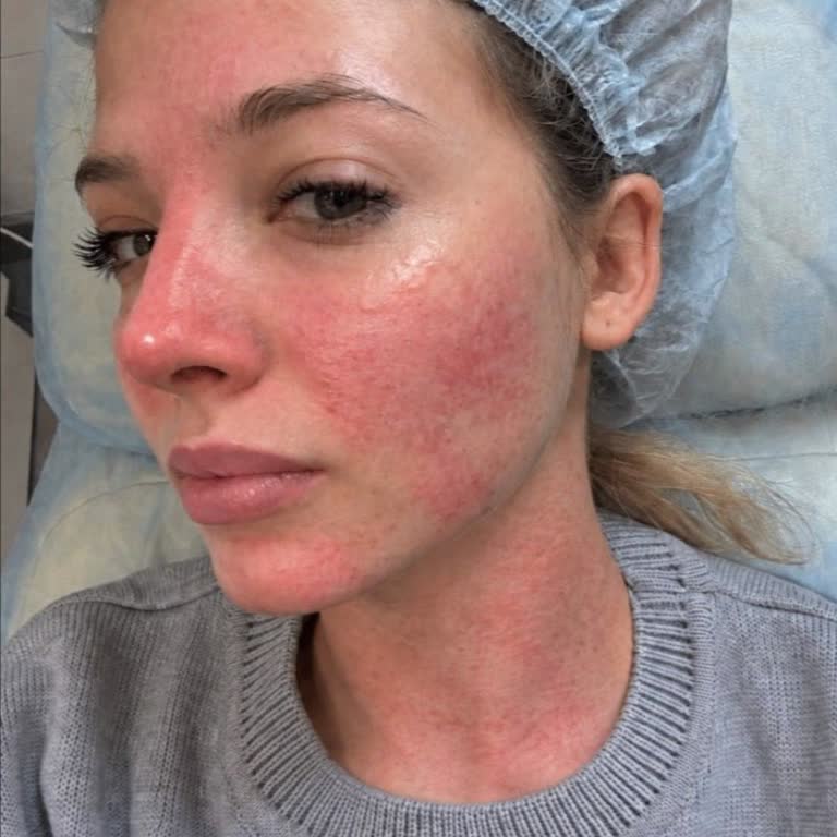 SHEIN Cosmetic Products Caused a Severe Allergic Reaction