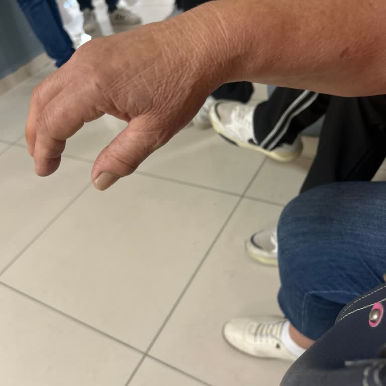 Otobüs Kapısına Sıkışan El İçin Özür Ve Güvenlik İyileştirmesi Talebi