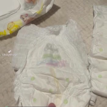 Sleepy Bebek Bezi Dokuları Farklı