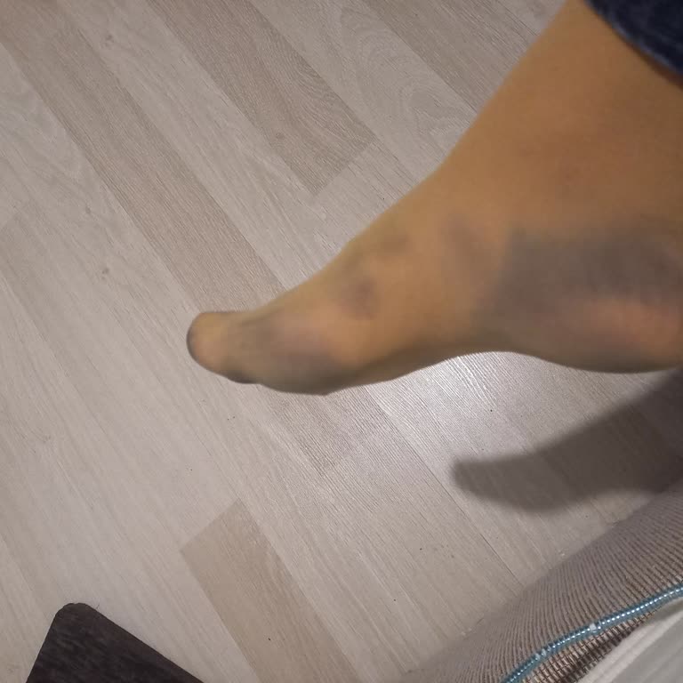 Ayakkabının Boyası Çorapları Boyadığı İçin Değişim Talebi