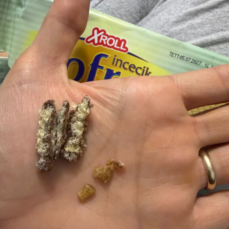 A101 Xroll Gofret İçinde Sert Plastik Benzeri Yabancı Madde Sağlık Riski Ve Şube İhmali