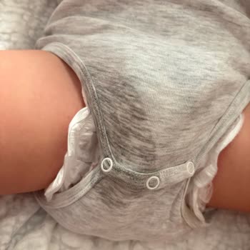 Molfix Bebek Bezlerinde Sürekli Sızdırma Ve İade Talebi