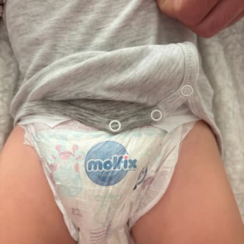 Molfix Bebek Bezlerinde Sürekli Sızdırma Ve İade Talebi