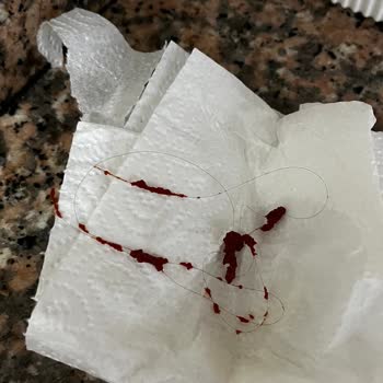 Tukaş Domates Salçasında Saç Teli: Hijyen Ve Güven Sorunu