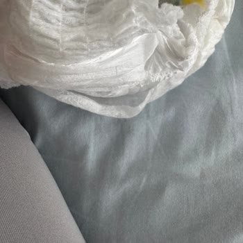 Hepsiburada’da Satın Alınan Molfix Bebek Bezinde Açılma Ve Sızıntı Problemi