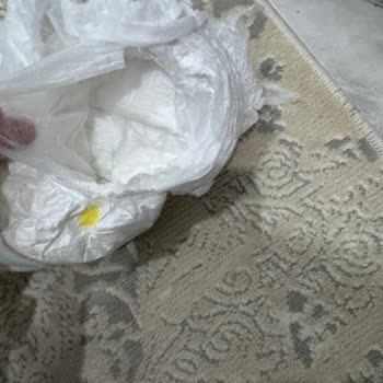 Hepsiburada’da Satın Alınan Molfix Bebek Bezinde Açılma Ve Sızıntı Problemi