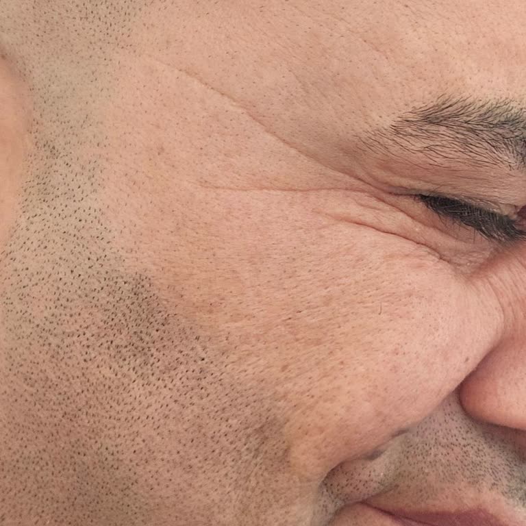 Yanlış Botoks Sonucu Ve Cevapsızlık Nedeniyle Ücret İadesi Talebi