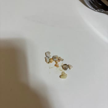 Yurdum Garnitür Kavanozunda Salyangoz Bulundu, Hijyen Endişesi