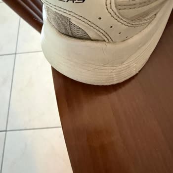 Skechers Ayakkabısında Kısa Sürede Deformasyon Ve Ürün Kalitesi Hayal Kırıklığı
