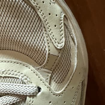 Skechers Ayakkabısında Kısa Sürede Deformasyon Ve Ürün Kalitesi Hayal Kırıklığı