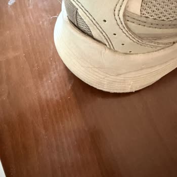 Skechers Ayakkabısında Kısa Sürede Deformasyon Ve Ürün Kalitesi Hayal Kırıklığı