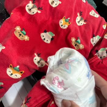 Molfix Bebek Bezinde Sürekli Sızdırma Sorunu Ve Ürün Değişimi Talebi