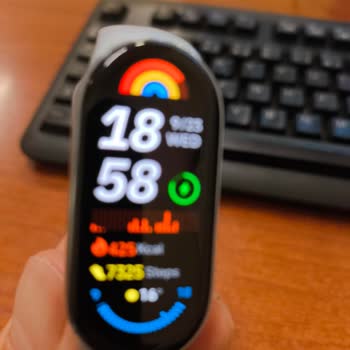 Xiaomi Smart Band 9 Kordonunun Kendi Kendine Çatlaması Ve Hepsiburada’nın Çözüm Sağlayamaması