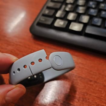 Xiaomi Smart Band 9 Kordonunun Kendi Kendine Çatlaması Ve Hepsiburada’nın Çözüm Sağlayamaması