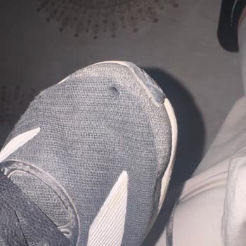 Adidas Ayakkabım Açıldı, Garanti Reddedildi