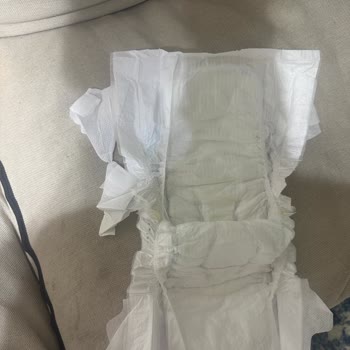 Molfix Comfy Like Mom’s Hug Bebek Bezinde Üretim Hatası: Cırt Cırt Tutarsızlığı