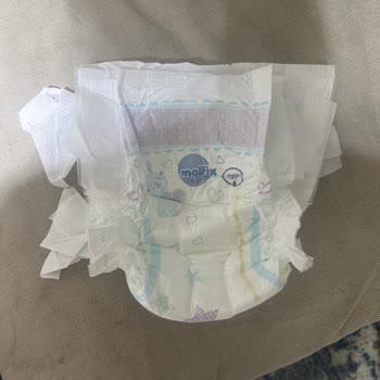 Molfix Comfy Like Mom’s Hug Bebek Bezinde Üretim Hatası: Cırt Cırt Tutarsızlığı