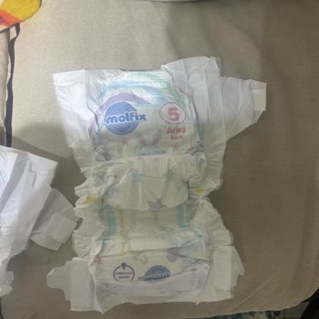 Molfix Comfy Like Mom’s Hug Bebek Bezinde Üretim Hatası: Cırt Cırt Tutarsızlığı