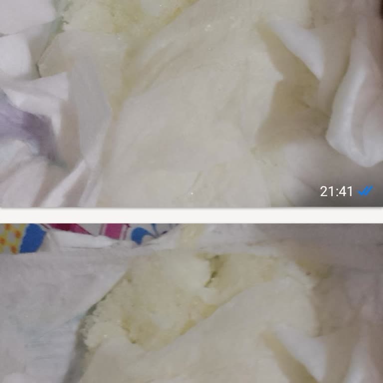 Molfix Bebek Bezinde İç Kısım Parçalanması Ve Hijyen Problemi