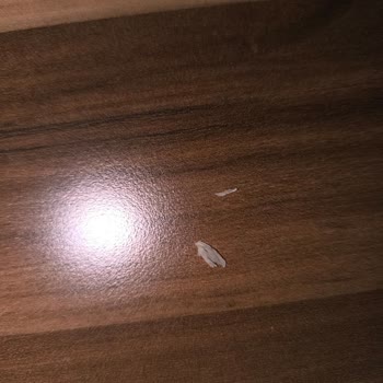 Dönerde Tırnak Görülmesi: Hijyen İhlali Ve Ücret İadesi Talebi