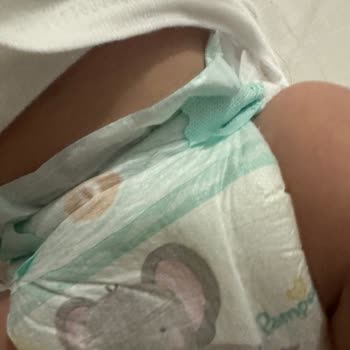 Prima Aktif Bebek Bezinde Gece Sürekli Taşma