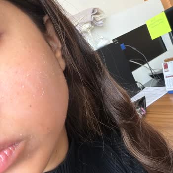 L'Occitane SPF 50 Güneş Kremi Uygulama Sorunu Ve İade Talebi