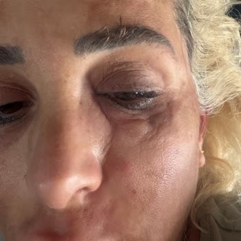 Işıltı Güzellik Merkezi Somon DNA İşlemini Yetkisiz Kişiler Yaptı